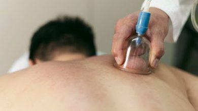 how-cupping-therapy-bellevue-connects-body-and-mind